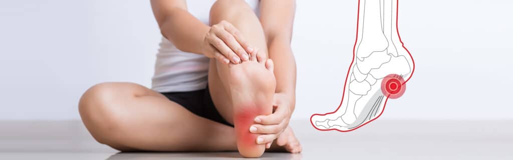 Pain relief from plantar fasciitis